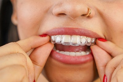 Man smiling at the dentist
