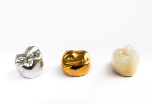 Three crowns lined up – one silver, one gold, and one tooth-colored.